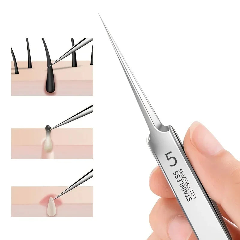 5 Cellular Blackhead Tweezers